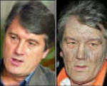 Yushchenko before and after his poisoning